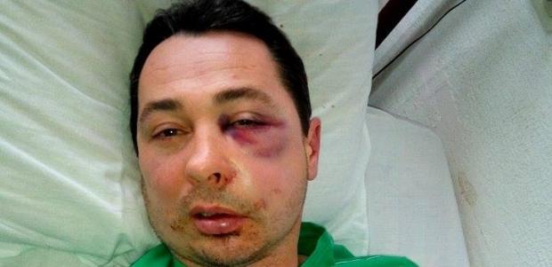 Ігоря Хомінця побили у під'їзді власного будинку. Фото:http://solydarnist.org/