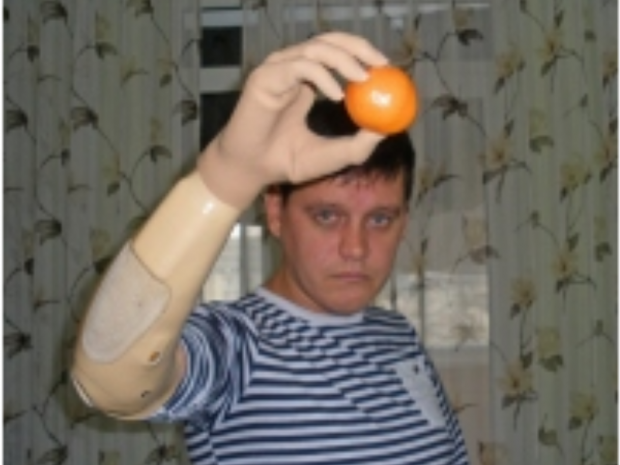 Сергій Товстик справляється з новим протезом. Фото: http://fakty.ua/