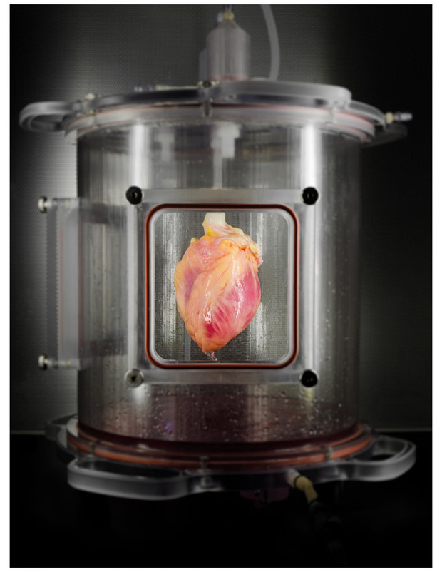 Прорив в області медицини: Американці виростили людське серце (фотофакт)