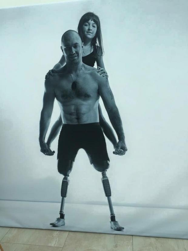 Герой, втративши дві ноги на війні, зумів повернутися до повноцінного життя. Фото: Facebook
