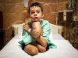 Страшне обличчя війни: Фото хлопчика, котрий підірвався на Донбасі, перемогло у міжнародному конкурсі (фотофакт 16+)