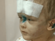 Скаліченому малюку знадобиться пересадка шкіри: Одесити стають в чергу, щоб всиновити дитину (відео)