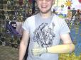 ​Львівському активісту, котрий втратив руку на Майдані, дістався перший український біонічний протез (фотофакт)