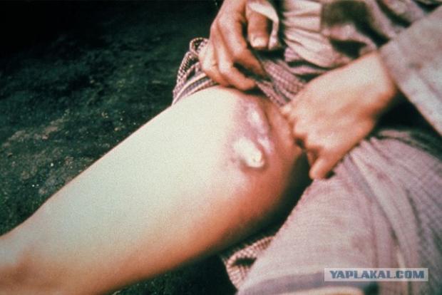 На Алтаї виявили бубонну чуму. Фото: yaplakal.com