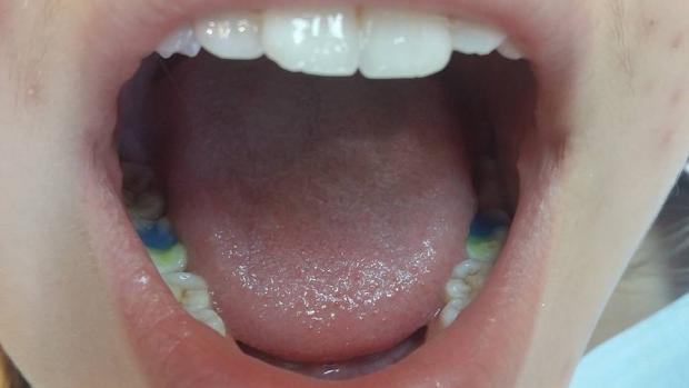 Як стоматологи в зоні АТО видирають зуби російській пропаганді - фото 6