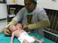 У Мексиці народилася дитина з двома головами (фото, відео)