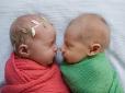 Найзворушливіша фотосесія маленьких близнюків: Батьки вирішили таким чином зберегти пам'ять про помираючого синочка (фото, від яких навертаються сльози)