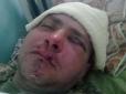 На Одещині сепаратисти жорстоко побили бійця з 