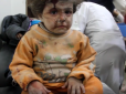 Что такое гуманизм по-русски? Для ватников дети присыпанные пылью после бомбёжек - как подарок судьбы - журналіст