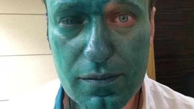 Навального облили зеленкою. Фото: ВВС.