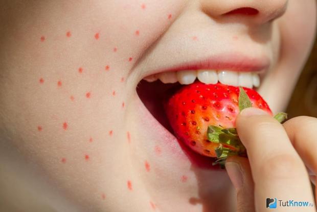 Алергія на фрукти. Фото: TutKnow.ru.