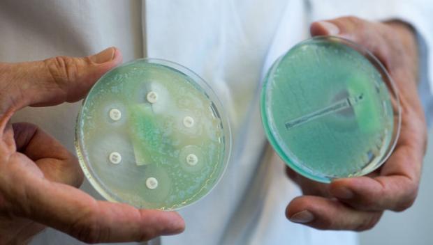 У США створено антибіотик, який вб'є всі супербактеріі. Фото: vesti.ru.