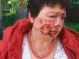 На голову Коцюбинської ТВК скоєно напад: Опоненти звинувачують її в інсценуванні (фото)