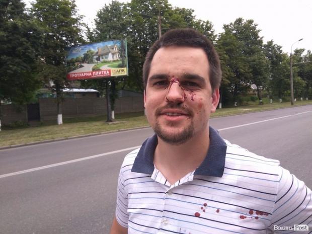 У Луцьку жорстоко побили учасника АТО. Фото: Фейсбук.