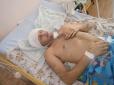 Четверо на одного: На Тернопільщині жорстоко побили учасника АТО (фото)