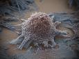 Генномодифіковані клітини застосують у лікуванні раку
