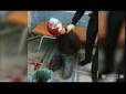 Неадекватний пацієнт напав на лікарів, які намагалися надати йому допомогу (відео)