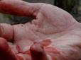 Жахлива знахідка: У парку Києва знайшли відрізану людську руку