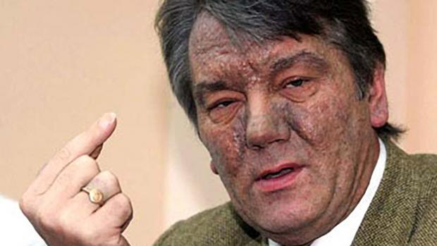 Віктор Ющенко після отруєння