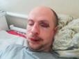 Залишили стікати кров'ю: На Київщині до напівсмерті побили ветерана АТО (фото)
