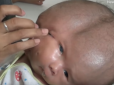 Не для нервових! В Індонезії народився хлопчик із двома обличчями і парою мізків (фото, відео)
