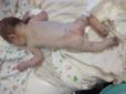 Звірі, а не люди! - На Кіровоградщині біля лікарні у коробці знайшли понівечене немовля (фото)