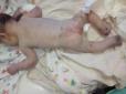 Малюк, якого підкинули в клініку на Миколаївщині, помер