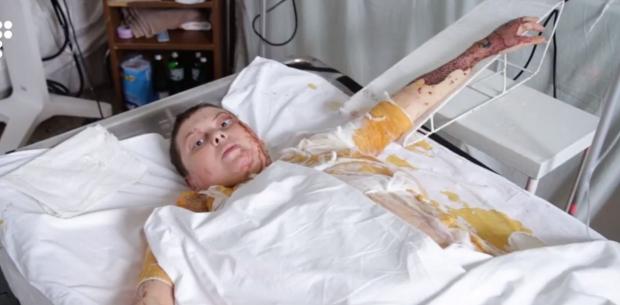 Катерина Гандзюк в лікарні. Фото:скрін відео