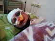 Напали зі спини: На Дніпропетровщині активісту кастетом проломили голову (фото)
