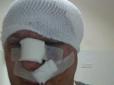 Хіти тижня. Помста? Догхантеру Святогору проломили череп на виході з суду (фото)