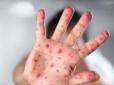Не тільки грип: Крим накрила небезпечна епідемія