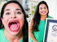 ​Найбільша пелька в світі: Жінка відкрила рота на 6,5 см і потрапила в Книгу рекордів Гіннеса