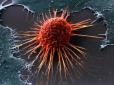 Коли треба бігом бігти на обслідування: Британські вчені виявили симптом раку, який проявляється вранці