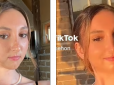 Була схожа на білку через рідкісну хворобу: Дівчина зробила операцію за $200 000, щоб змінити обличчя (фото)