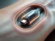 Людина-батарейка: Вчені створили бездротовий підшкірний зарядний пристрій