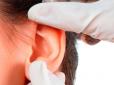 Можна вірити, можна не вірити, а можна перевірити: Про які риси характеру свідчить форма вух. Тест