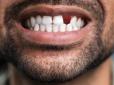 Втрачені зуби зможуть знову відрости. Революційний японські ліки успішно випробували на тваринах та почали тестувати на людях