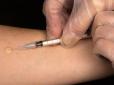 Пробу Манту в Україні поступово скасовують? Українцям повідомили про важливі зміни