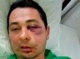 Під Херсоном побили депутата від БПП - нині у лікарні (фото)