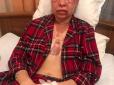 Жахлива трагедія: У Дніпрі невідомий облив жінку кислотою (фото)