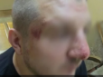 Цей більше не поїде до агресора? Російські прикордонники побили українця (відео)