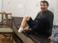 Жах та й годі: Через гангрену українець сам собі відрізав ногу, бо не міг заплатити лікарям (відео 12+)
