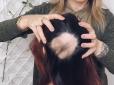 Дива сучасних перукарів: Як змінилась зачіска практично лисої дівчини (відео)