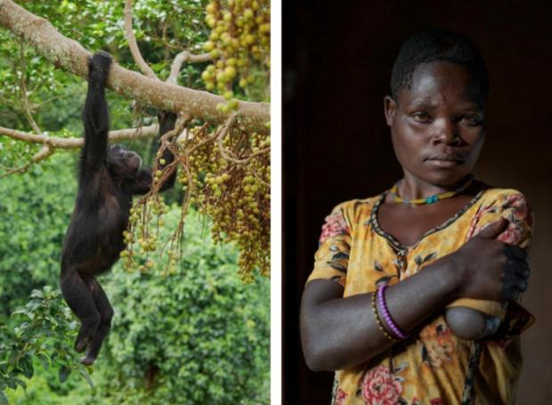 Шимпанзе, який втратив обидві стопи в людських пастках і Тедді Атухайре, яка втратила руку через напад примату.