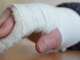 Скрепна медицина: Російські лікарі діагностували у чоловіка з переломом руки вагітність