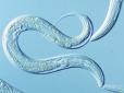 Вчені знайшли спосіб продовжити життя до 400-500 років за допомогою черв'яків