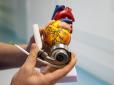 Механічний орган виготовили у США: В Україні провели унікальну операцію на серці