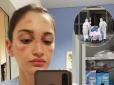 23-річна медсестра з Італії показала обличчя після багатогодинної роботи в масці і надихнула мережу