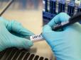 Посмертне виявлення коронавірусу: Лікар розповів про причини запізнілого діагнозу