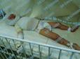 Лікарі б'ються за життя: У Дніпрі розігралася страшна трагедія з маленькою дитиною (фото)